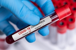 საგარეჯოს კლინიკის ექთანს, რომელსაც კორონავირუსი დაუფიქსირდა, PCR-ით იკვლევენ