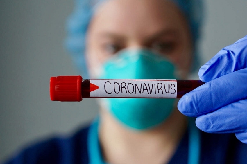 საქართველოში კორონავირუსის 342 ახალი შემთხვევაა, გარდაიცვალა 44 პაციენტი